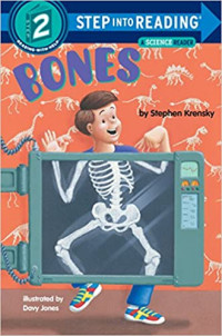 Bones