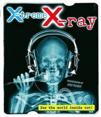 X-Treme X-Ray